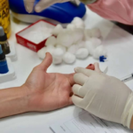 Delving into STD Testing PulseColon