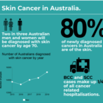 Why Skin Cancer is Australia Most Common Cancer