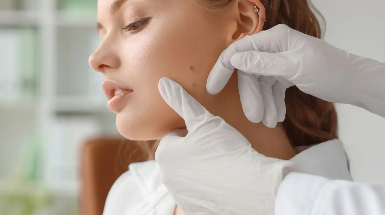 How to Remove Moles Naturally at Home